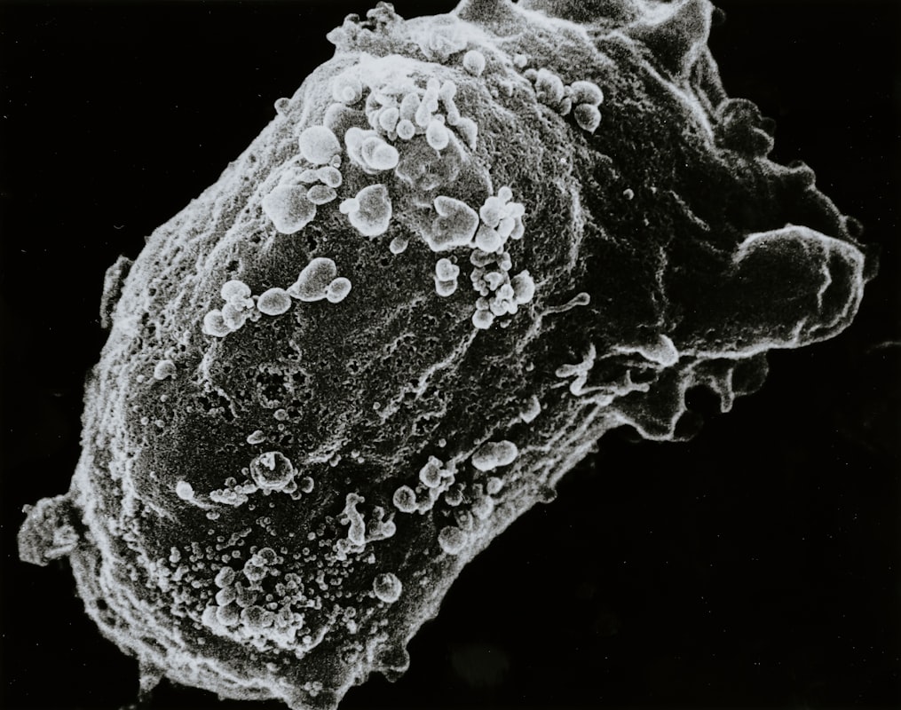 Giardia